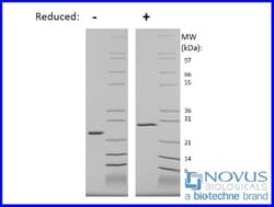 Novus Biologicals Recombinant Human WISP2 Protein 100 μg | Buy Online | Novus Biologicals™ | Fisher Scientific